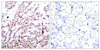 ATF2 Antibody