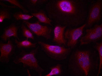 ATF2 Antibody