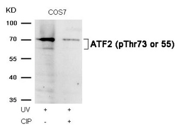 ATF2 Antibody