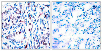 STAT3 Antibody