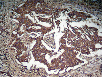 STAT3 Antibody