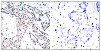 STAT3 Antibody