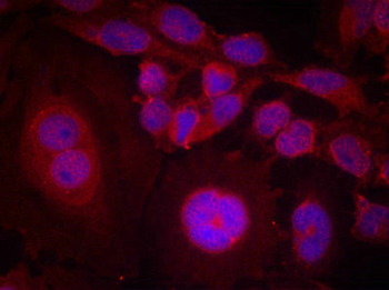 STAT3 Antibody