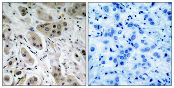 AKT1 Antibody