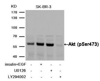 AKT1 Antibody