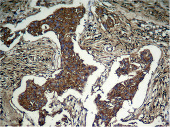 AKT1 Antibody