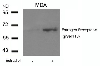ESR1 Antibody
