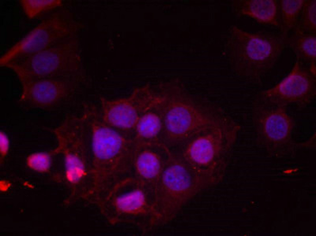 ESR1 Antibody