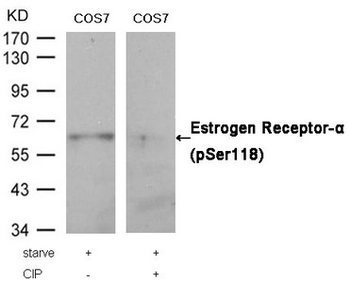 ESR1 Antibody