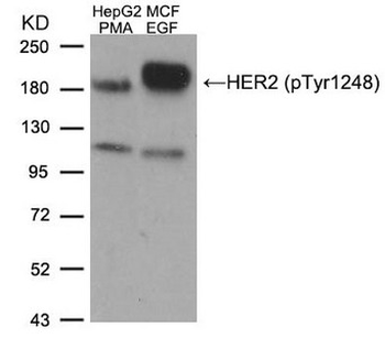 ERBB2 Antibody