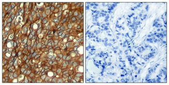 ERBB2 Antibody