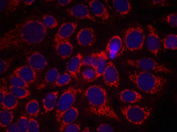 ERBB2 Antibody