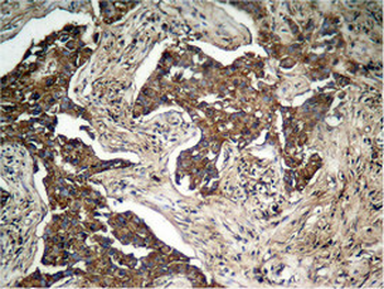 ERBB2 Antibody