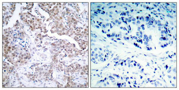 TP53 Antibody