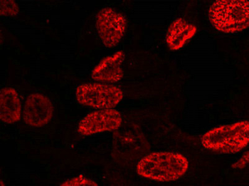 TP53 Antibody