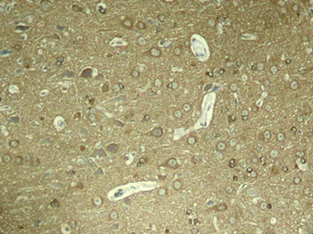MAPT Antibody
