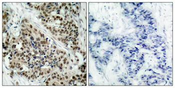 FOXO1 Antibody