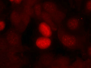 FOXO1 Antibody