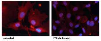 FOXO1 Antibody