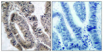 PRKAA1/PRKAA2 Antibody