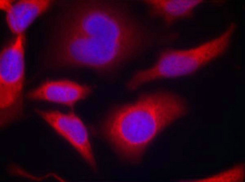 PRKAA1/PRKAA2 Antibody