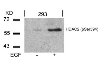 HDAC2 Antibody