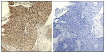 HDAC2 Antibody
