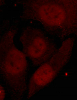 HDAC2 Antibody