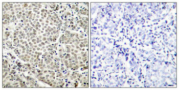 RELA Antibody