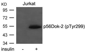 DOK2 Antibody