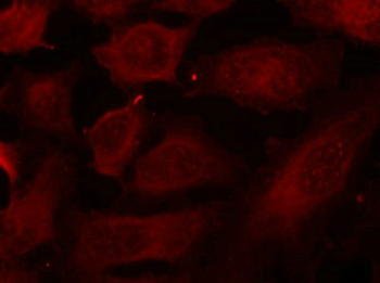 DOK2 Antibody