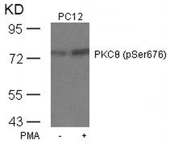 PRKCQ Antibody
