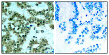 PRKCQ Antibody