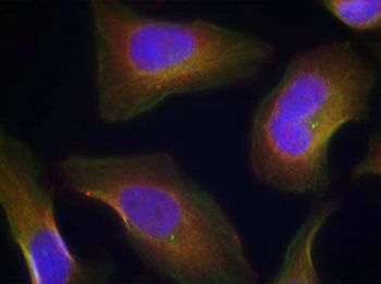 PRKCQ Antibody