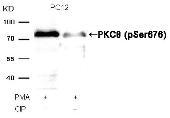 PRKCQ Antibody