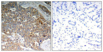 GSK3A/GSK3B Antibody