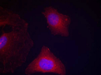 GSK3A/GSK3B Antibody