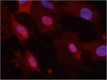 GSK3A/GSK3B Antibody