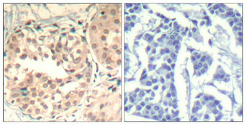 CDK6 Antibody