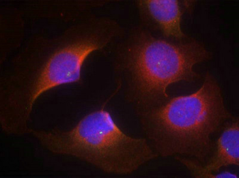 CDK6 Antibody