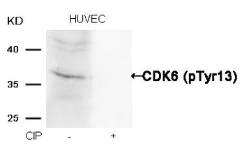 CDK6 Antibody