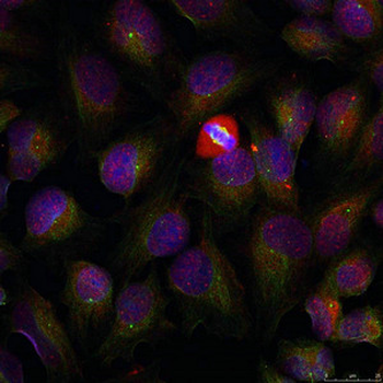 NFKB1 Antibody
