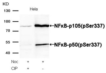 NFKB1 Antibody