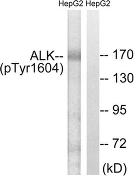 ALK Antibody