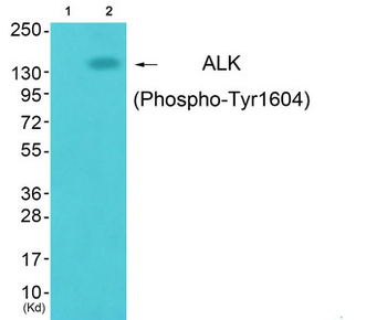ALK Antibody