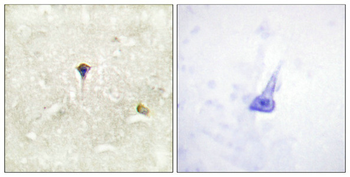 ALK Antibody