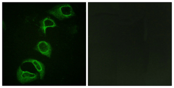 ALK Antibody