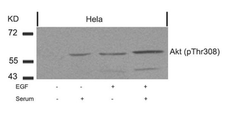 AKT1 Antibody
