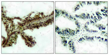 AKT1 Antibody