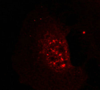 AKT1 Antibody